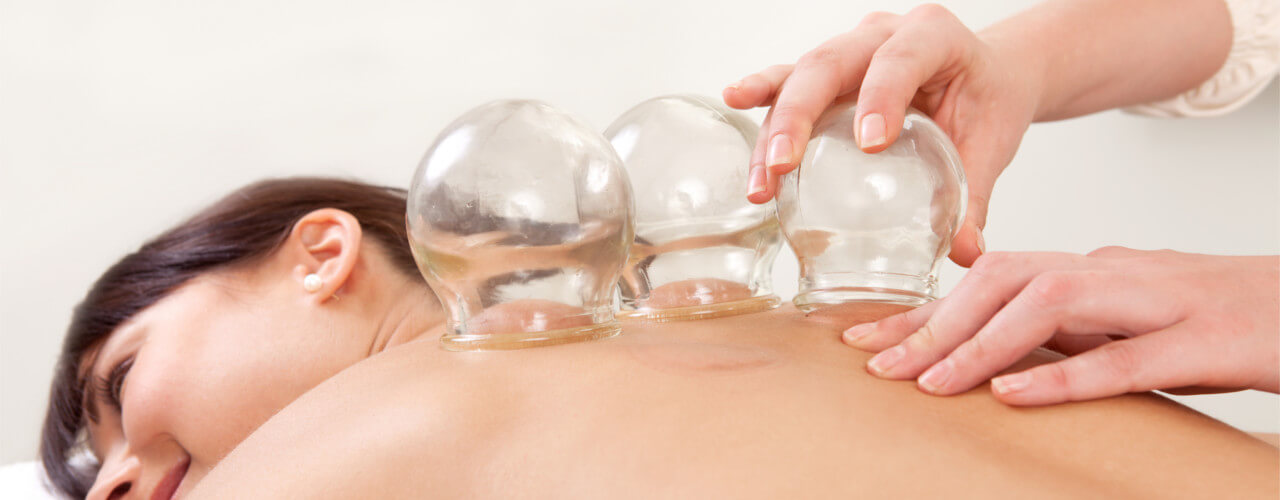 Cupping Therapy Newtonville & Brookline, MA